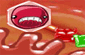 Bioblast