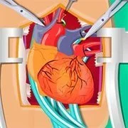 Heart Surgery Simulation